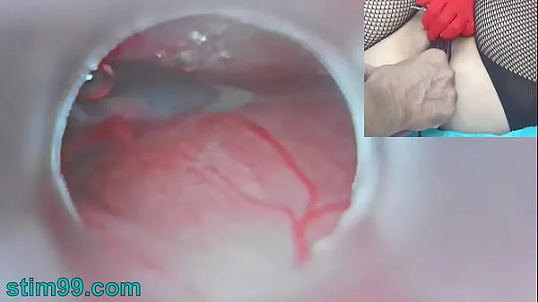Show Uncensored Japanese Insemination with Cum into Uterus and Endoscope Camera by Cervix to watch inside womb my Movies